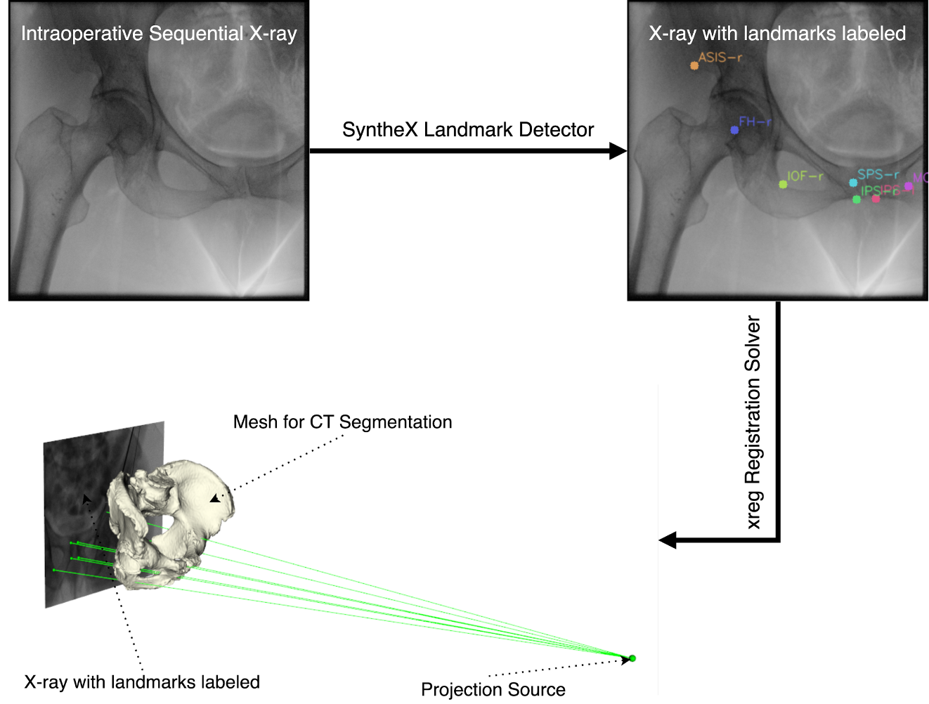 XREGI: Learning-based 2D/3D Fluoroscopic Image Registration